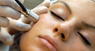 microdermasion1